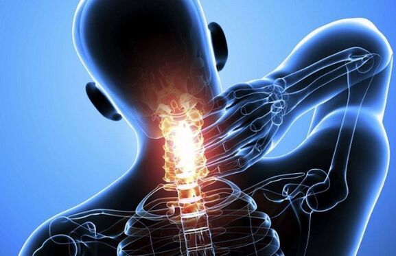 Pain in the neck