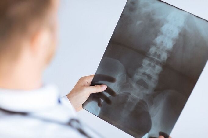 Diagnostic Options for Lomber Osteocondrosis