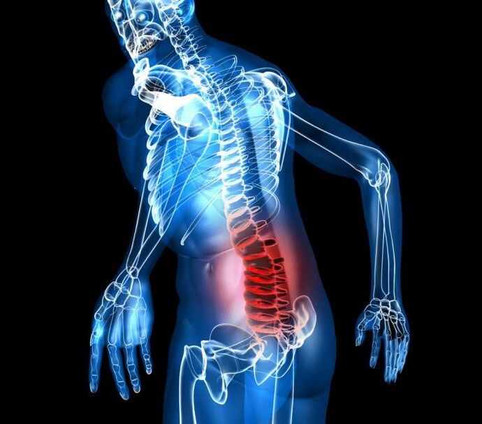 Rate and development of lomber osteocondrosis