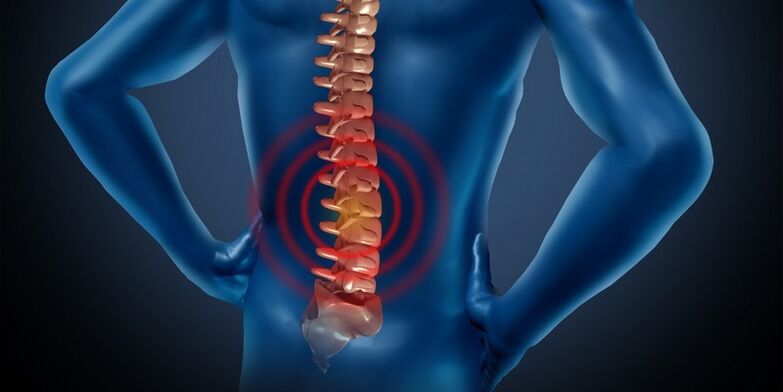 Osteocondrosis of the Lumbar region