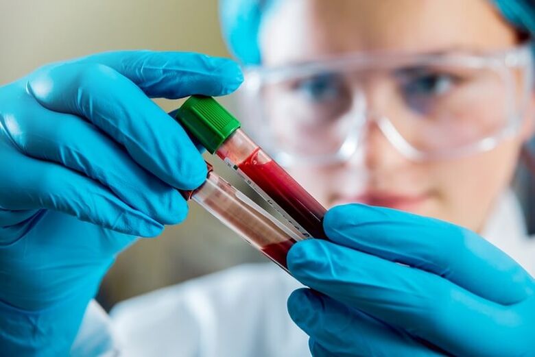 Complete blood test to diagnose back pain