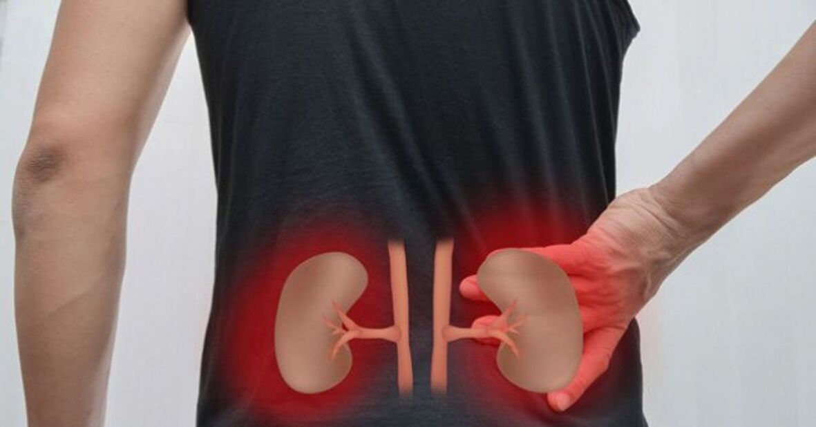 Inflammation of the kidneys can cause back pain